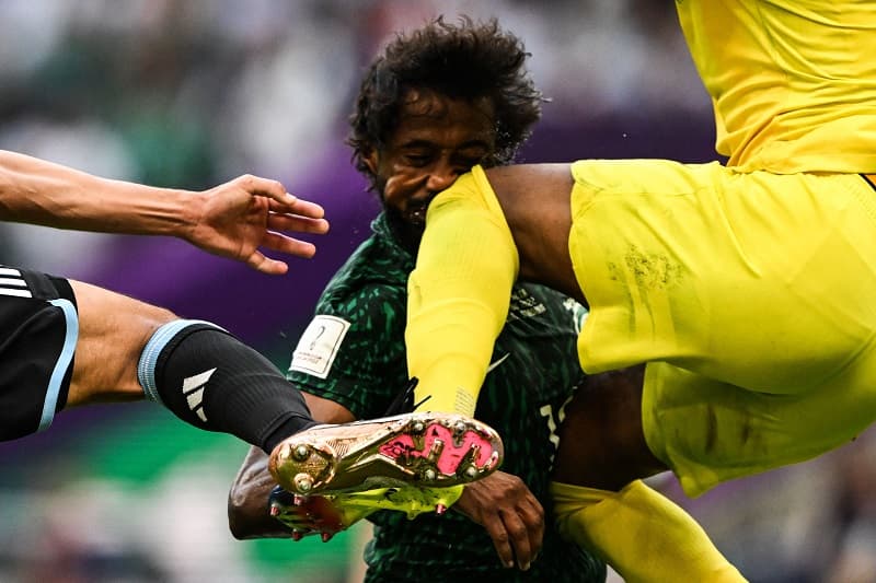 Lateral e goleiro da Arábia Saudita se chocaram em jogo da Copa do Mundo