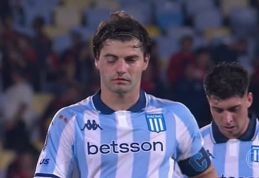 Com o rosto bastante machucado, Sosa deixa o gramado do Maracanã após Flamengo x Racing