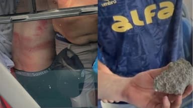 Imagens de torcedores do Grêmio feridos e de pedra jogada por torcedores do Internacional antes da final do Gauchão, no Beira-Rio