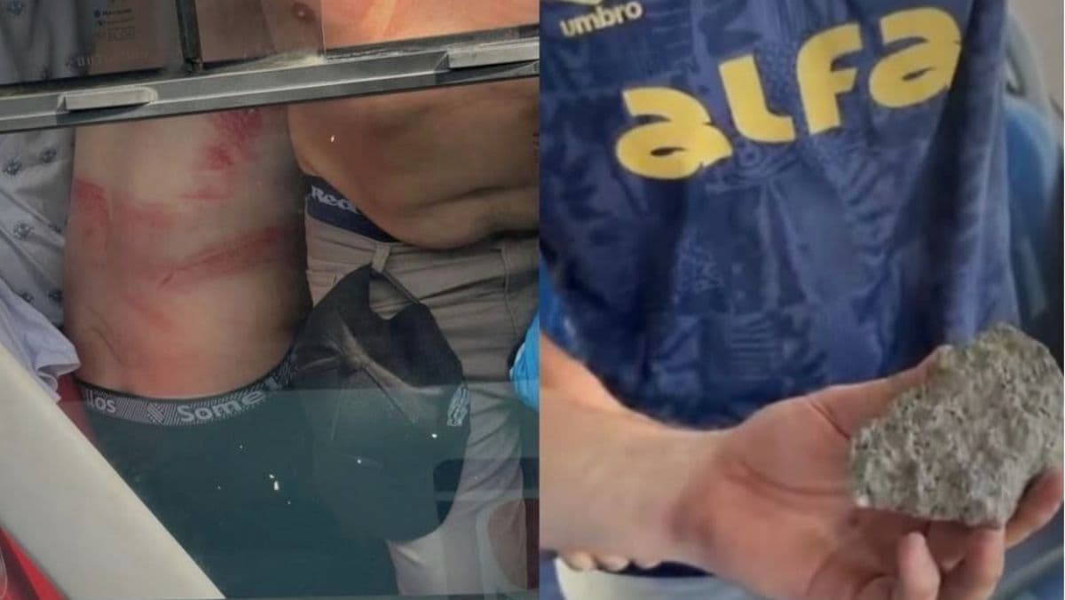 Imagens de torcedores do Grêmio feridos e de pedra jogada por torcedores do Internacional antes da final do Gauchão, no Beira-Rio